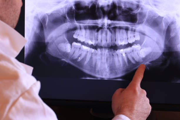 Best Pediatric Emergency Dentist in West Wareham, MA